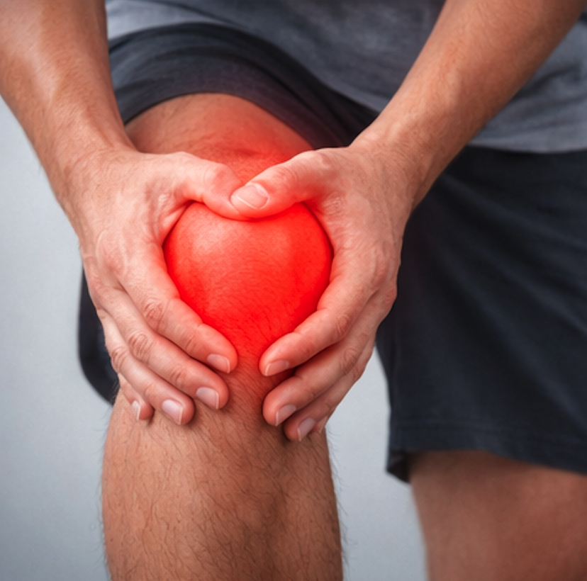 Rodilla
