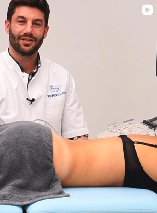 Procedimiento ecoguiado — Dr. Mailand